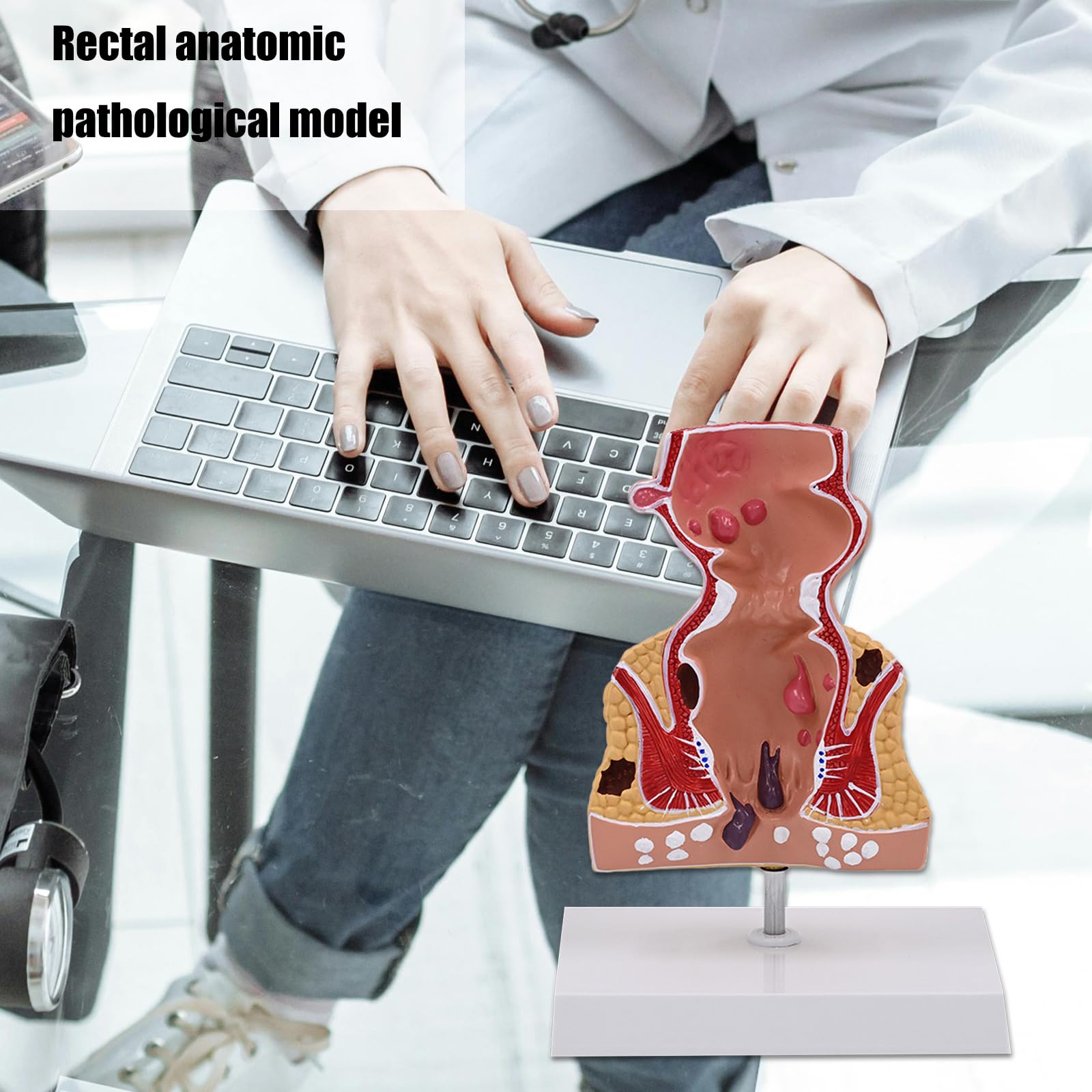 Modello retto per anatomia aiuto didattico patologie umane pratiche del retto modello di materiale scolastico umano per anatomia