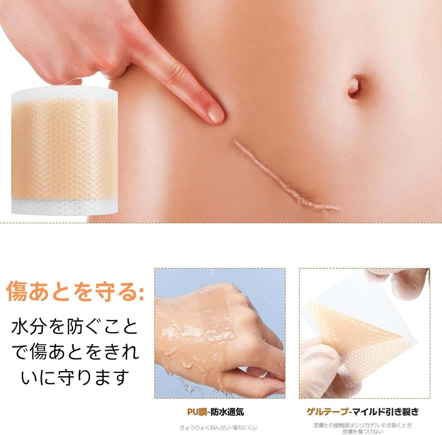 Amazon.co.jp: zhihu 傷跡ケアテープ ケロイド テープ 4cm×300cm 傷