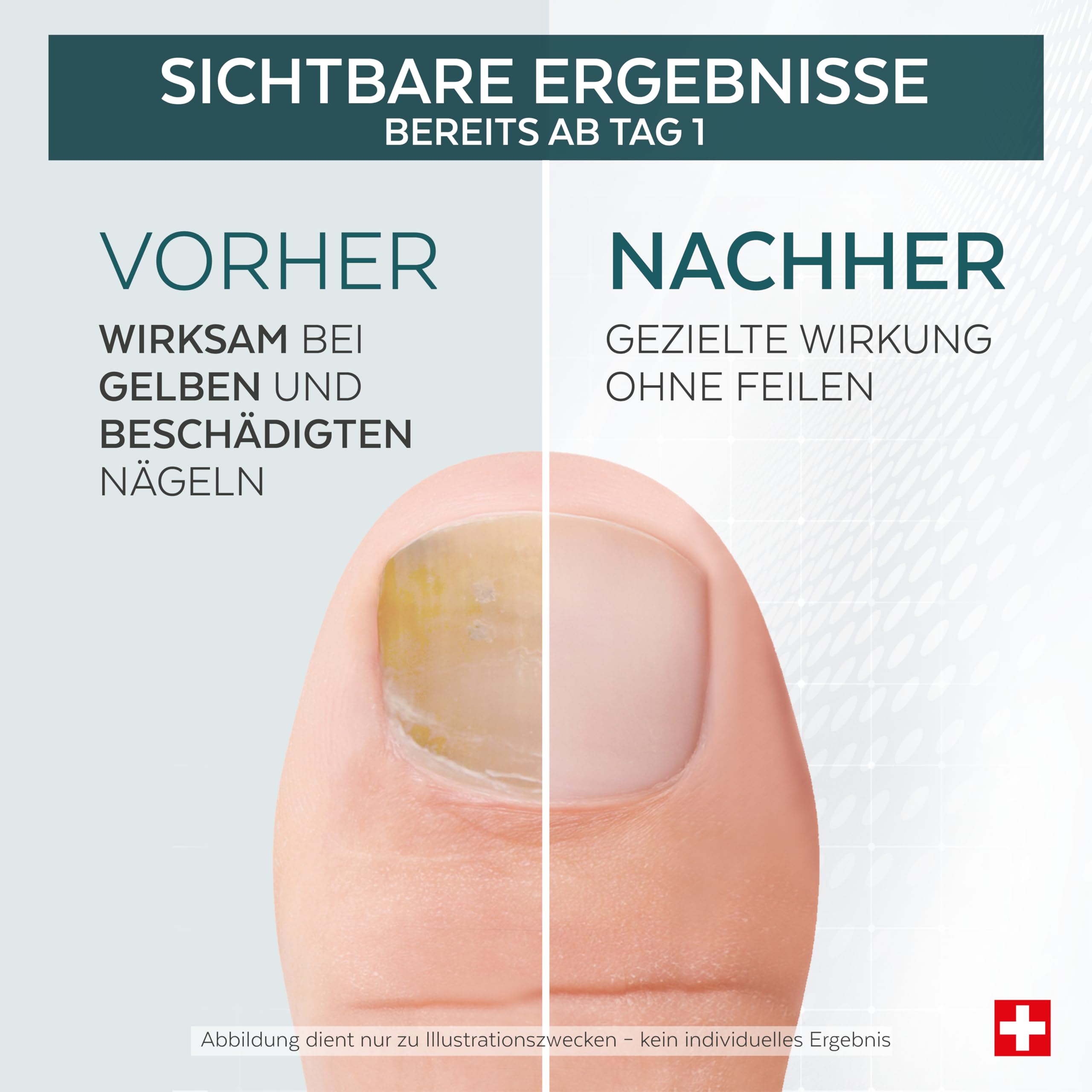 PODERM Tea Tree Nagel-Repair-Serum 6 ml – 4-in-1 Pflege | Verbessert das Erscheinungsbild beschädigter, vergilbter und matter Nägel – Sichtbare Ergebnisse ab dem 1. Tag – Swiss Made