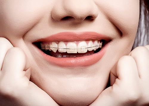 Miniatura 7 de Cera de ortodoncia, cera dental para ortodoncia, alivio oral, protección de labios, selecciona el tamaño de tu paquete, fabricado en EE. UU.