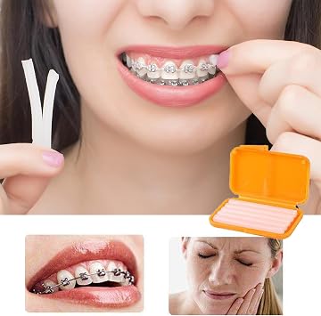 Pack of 10 Braces Wax Orthodontic Wax for Braces Braces Wax to Relieve Irritation Pain (10 Types of Flavour)