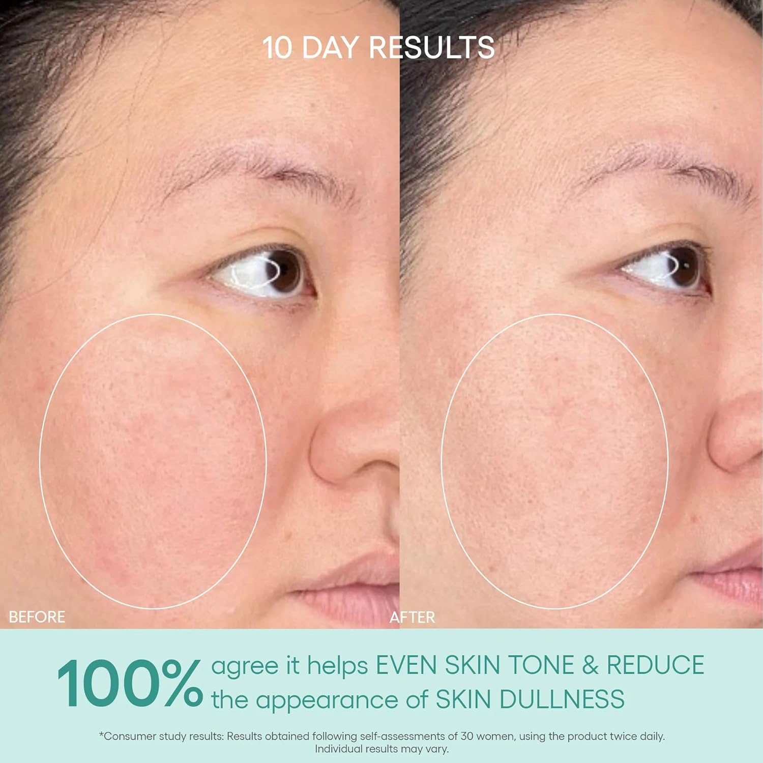 Algenist GENIUS Liquid Collagen Essence - Liquid Collagen Serum with Patented Alguronic Acid to Help Improve Skin Bounce, Elasticity & Radiance (3.4 oz)