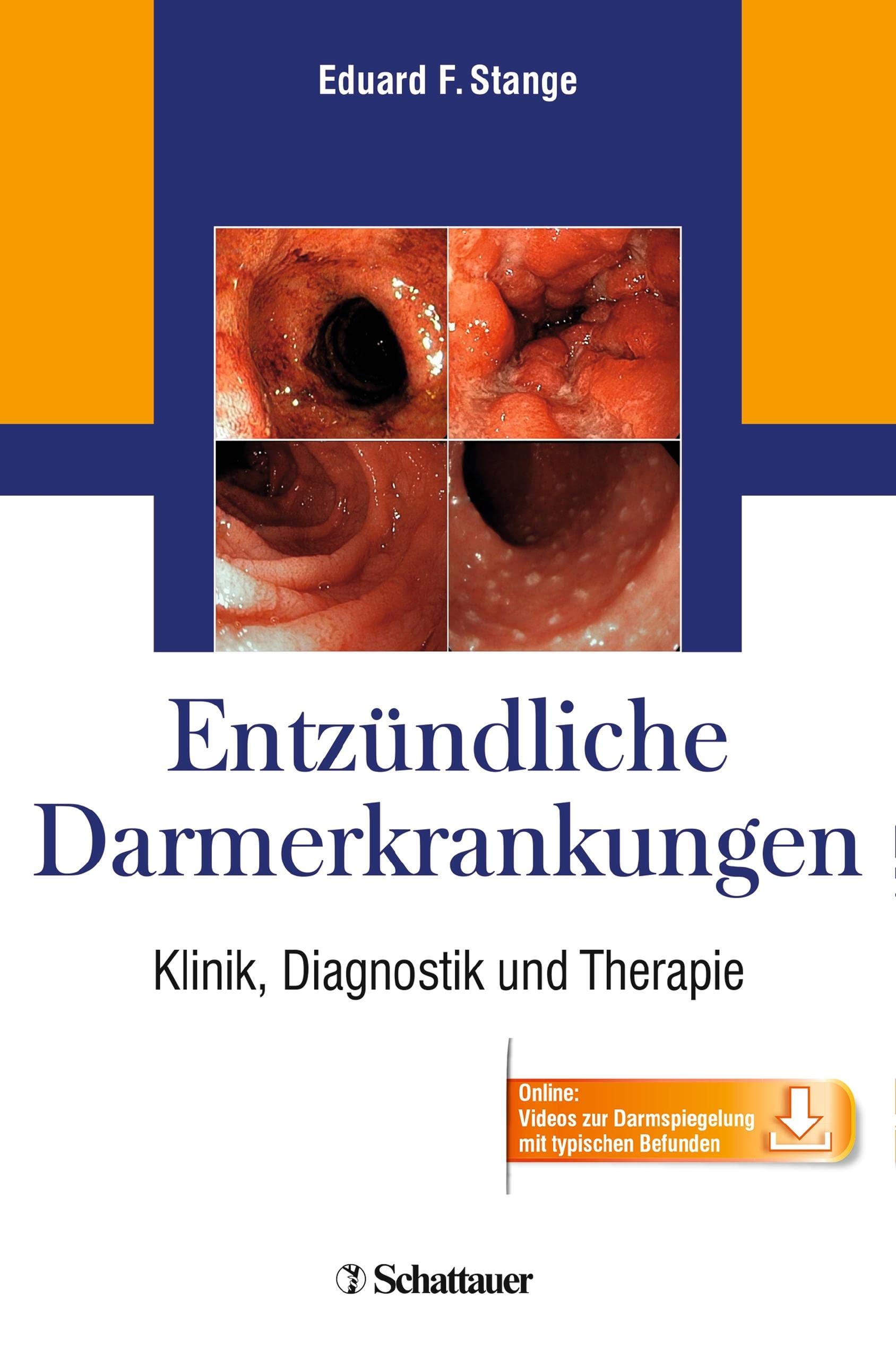 Entzündliche Darmerkrankungen: Klinik, Diagnostik und Therapie - Online: Videos zur Darmspiegelung mit typischen Befunden