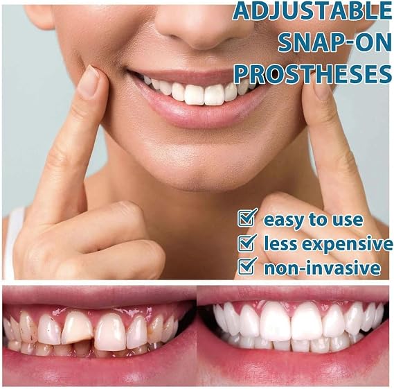 False Teeth Set, Clip in Veneers Teeth, Dentures Tooth Top and Bottom, Instant Smile Clip in Dentures, Comfortable Temporary Veneers for Men & Women, Tooth Repair Kit