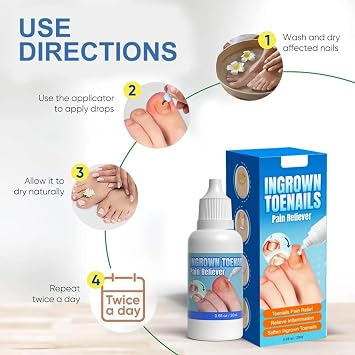 Ingrown Toenail Treatment Extra Strong | Nail Care Solution for Ingrown Toenails | Soften Thick Nails and Support Healthy Nail Growth 20ml