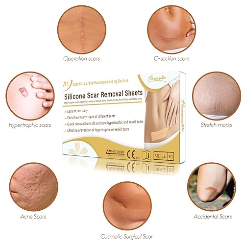 Miniatura 5 de Femfresh - Lavado íntimo diario - con Aloe Vera calmante - pH equilibrado - 8.5 fl oz