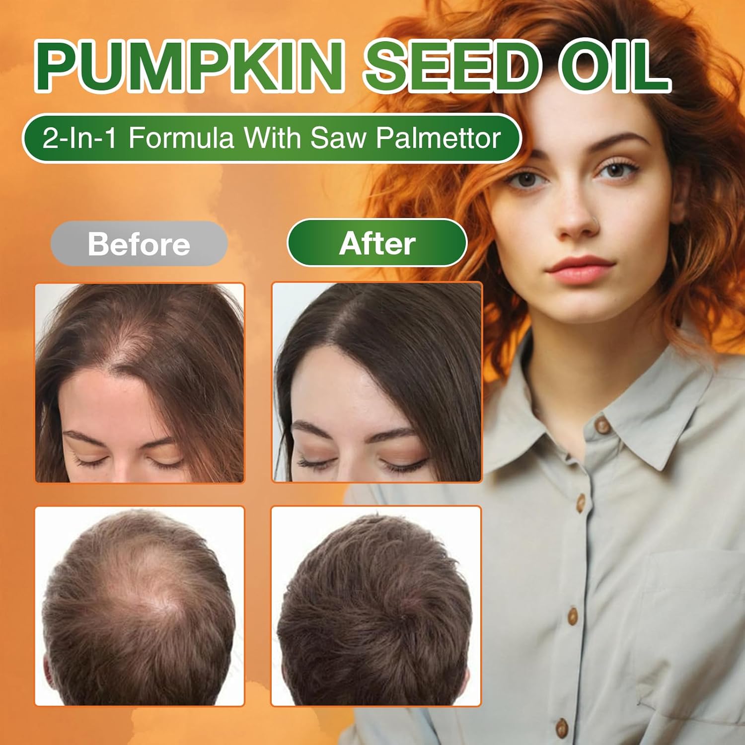 Pumpkin Seed Oil Capsules - Saw Palmetto Pumpkin Seed Oil 300 Softgels Prostate Health, Immune and Urinary Tract Support Promotes Hair Growth - Pure Non GMO