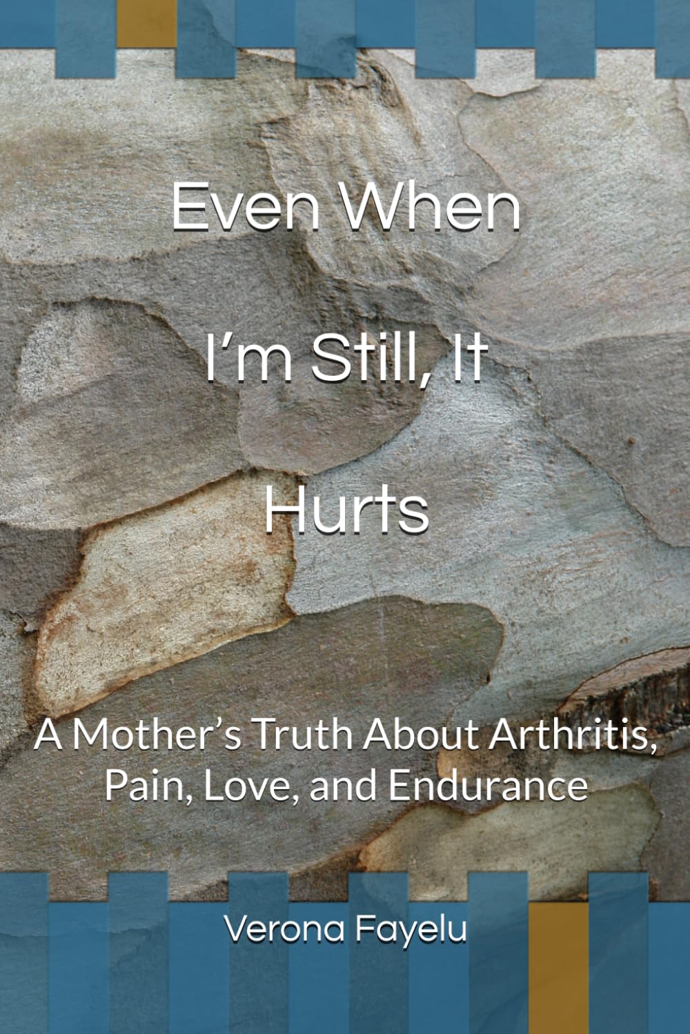 Even When I’m Still, It Hurts: A Mother’s Truth About Arthritis, Pain, Love, and Endurance