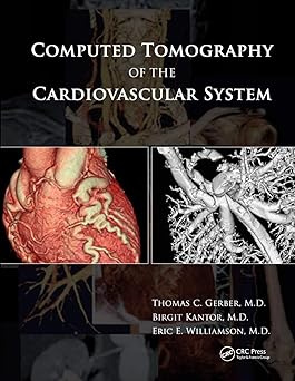 COMPUTED TOMOGRAPHY OF THE CARDIOVASCULAR SYSTEM (PB 2019)