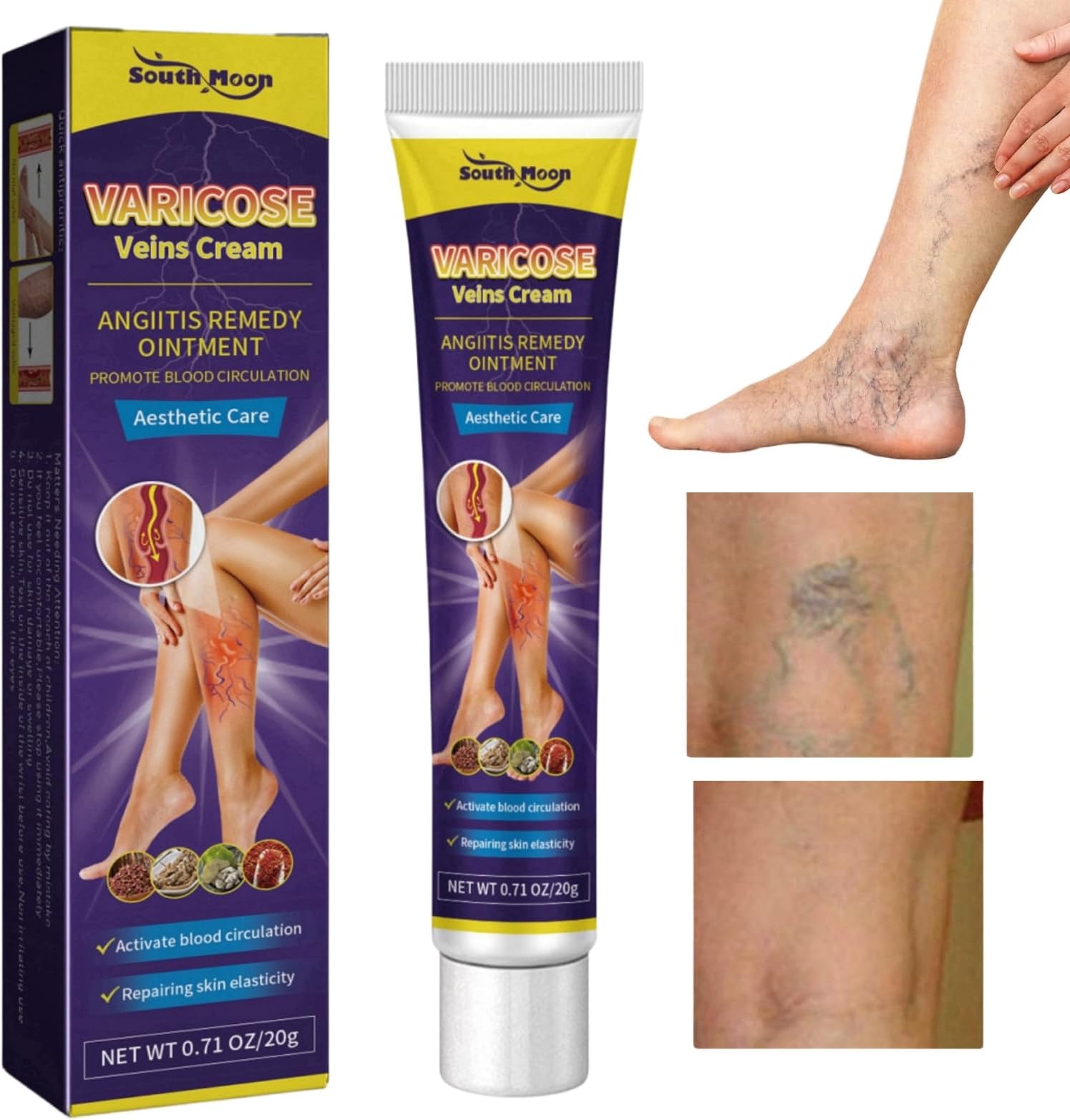 Varicose Veins Cream,Spider Vein Cream,Varicose Veins Relief Cream,Spider Veins Repair Cream,Varicose Veins Treatment for Legs,Vein Cream for Legs Aching Legs Relief,Cream for Varicose Veins in Legs