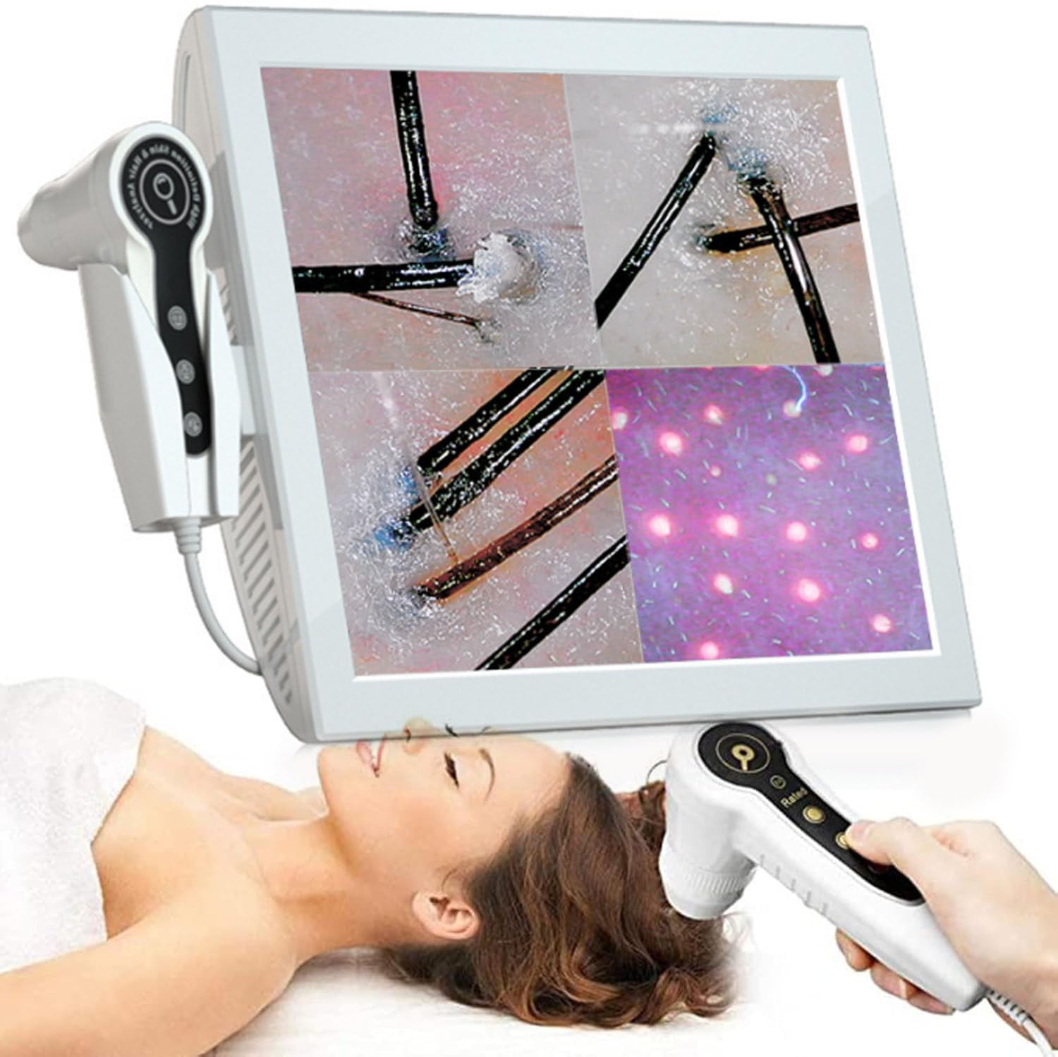 Analizzatore per Capelli e diagnosi della Pelle, 15 Pollici 50X 200X Cuoio capelluto follicolo pilifero Pelle, rilevatore di Cuoio capelluto Capelli Pelle, Tester follicolo pilifero