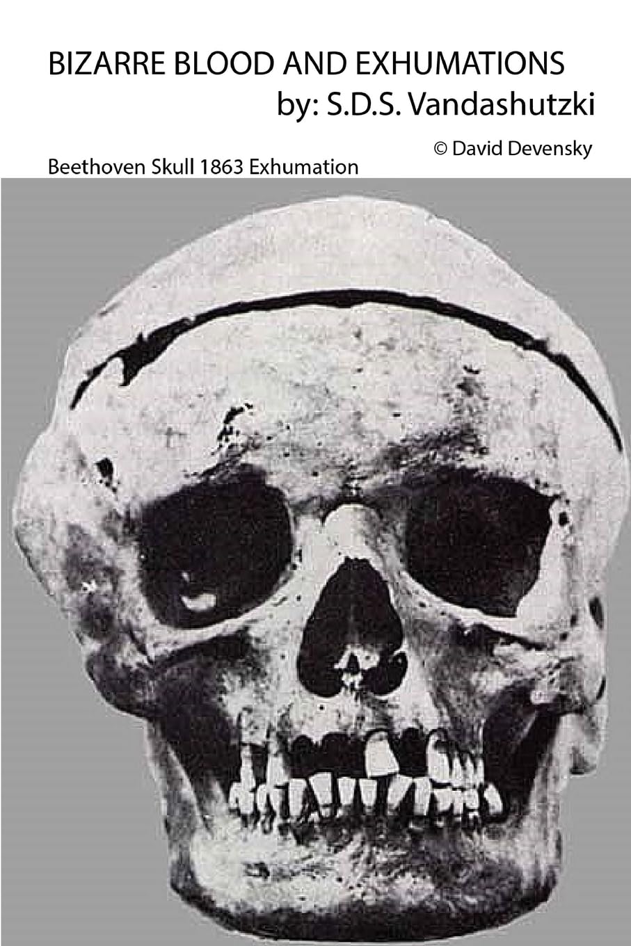 Bizarre Blood and Exhumations