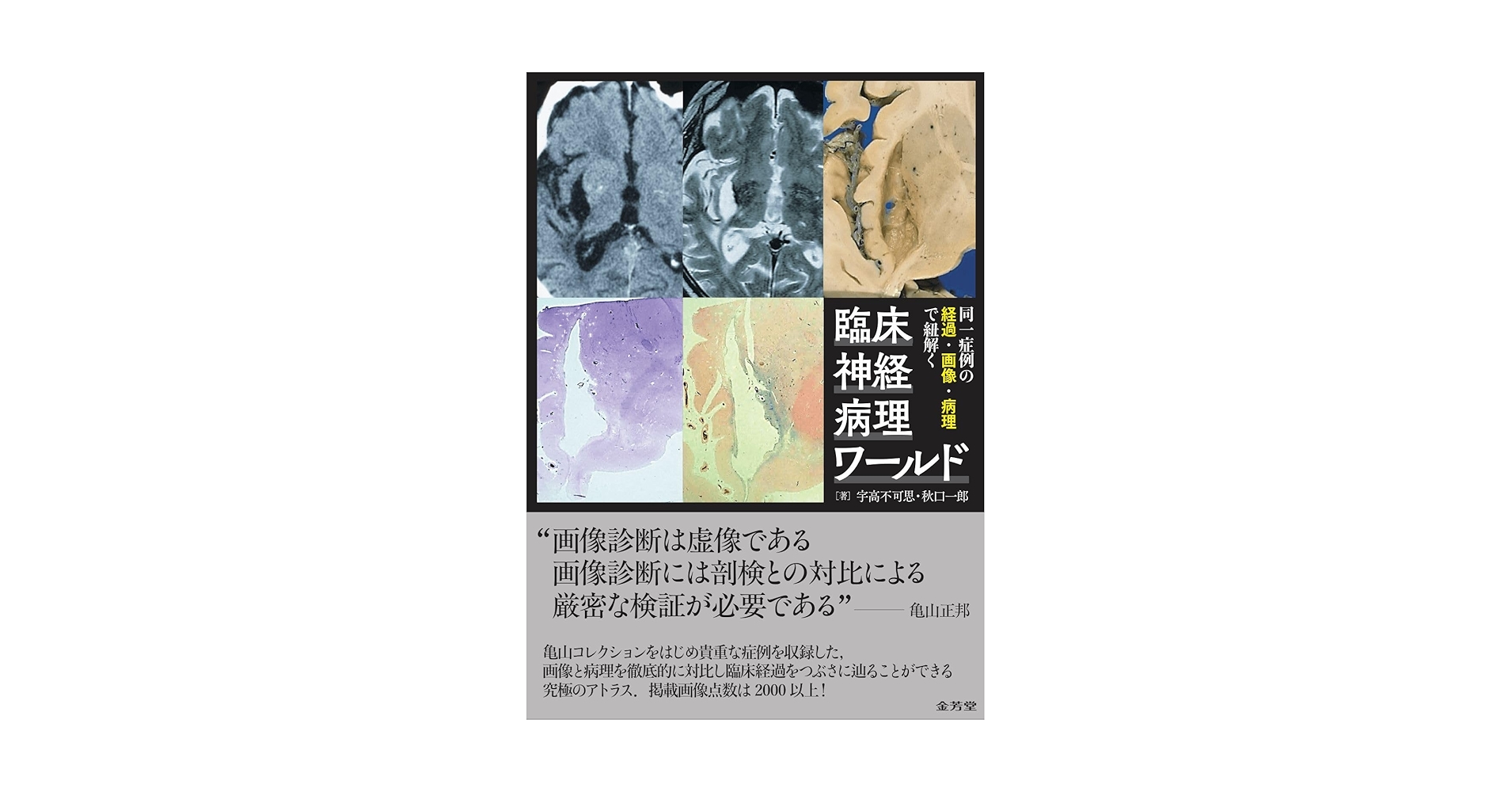 裁断済　臨床神経病理ワールド 同一症例の経過・画像・病理で紐解く 臨床神経病理ワールド