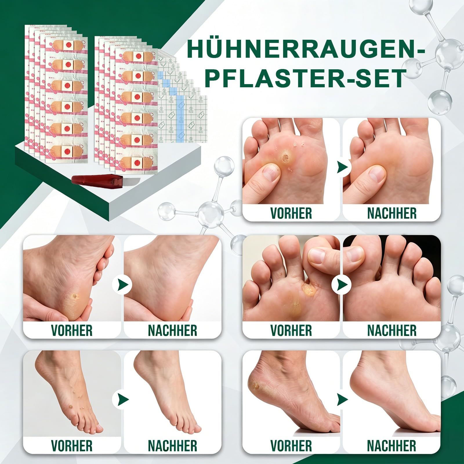 60 Stück Hühneraugenpflaster, Hühneraugen Entferner, Corn Removal Pads Zur Entfernung von Hühneraugen, Hornhaut und Schwielen, Lindert Schmerzen