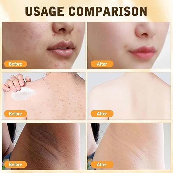 Bee Venom Skin Restoration Cream, Bee Venom Comprehensive Creams, Firming Moisturizing & Repair Reduces Blemishes for All Skin Type (2 Bottle*60ML)