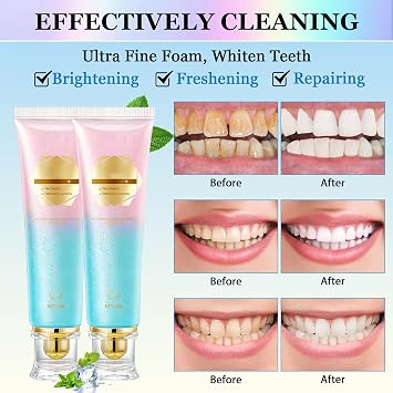 2Pcs Niacinamide Whitening Toothpaste Acssart Radiant White Toothpaste,Niacinamide Intensive Whitening Toothpastes,Nicotinamide Radiant Whiten Toothpastes