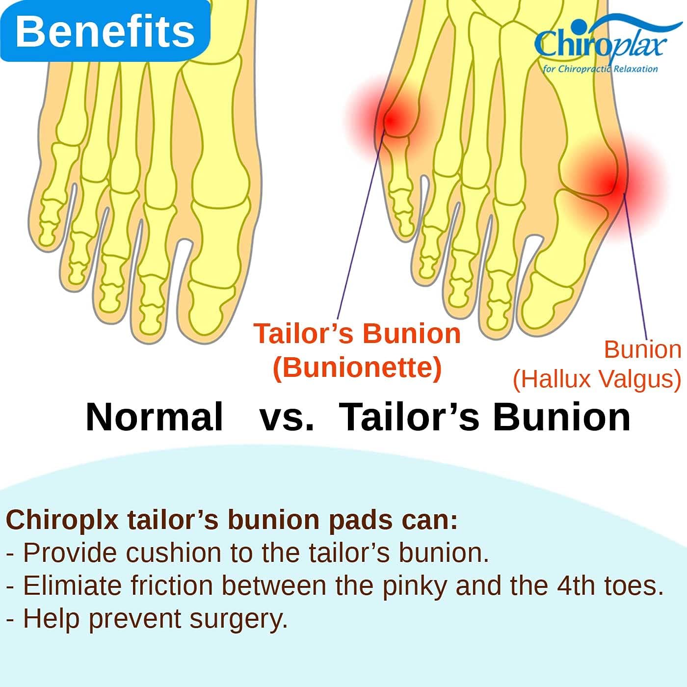 Chiroplax Tailor's Bunion Corrector Pads Bunionette Pain Relief Pinky Toe Separator Cushion Splint Protector Shield Spacer Cover Guard (4 Pads, Shims - Size Regular) : Health & Household