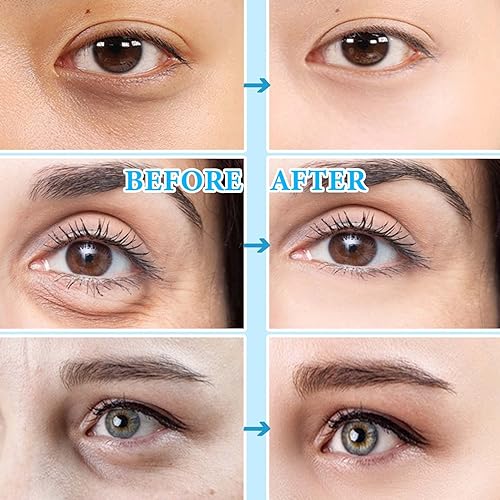 Miniatura 3 de WENJLYJ 30 pares de mascarillas doradas para ojos para ojeras e hinchazón, reduce las bolsas de ojos y suaviza las esponjosas, mejora la elasticidad