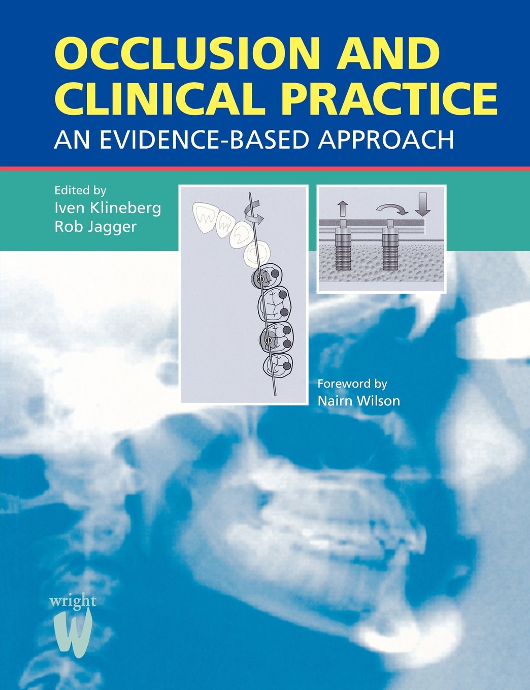 Buy Occlusion and Clinical Practice: An Evidence-Based Approach — BookShops.in