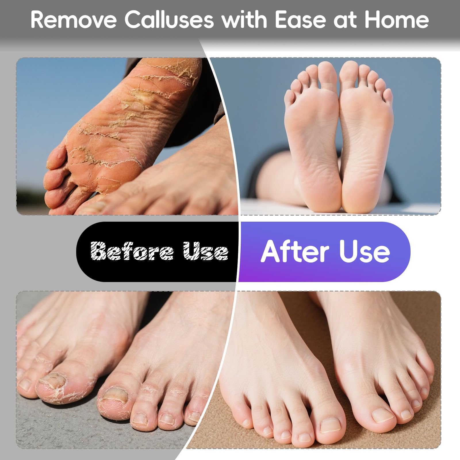 StepLively Removedor eléctrico de callos de pies, removedor de callos de 4.7 pulgadas para pies con 60 discos de papel de lija, limpiador de pies, herramientas profesionales de pedicura de control de