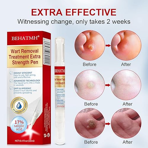 Miniatura 6 de BEHATMH Paquete de 3 removedor de verrugas con punta de precisión, ácido salicílico de máxima resistencia para verrugas comunes y plantares,