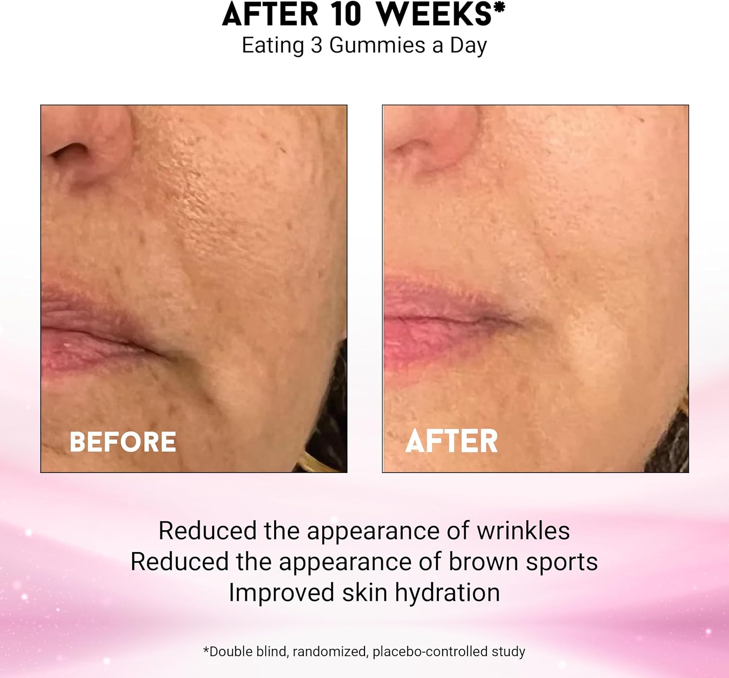 Joyce Giraud Ultimate Beauty Gummies, 60-Day Supply, Supports Skin Hydration & Healthy Skin Tone, 180 Gummies