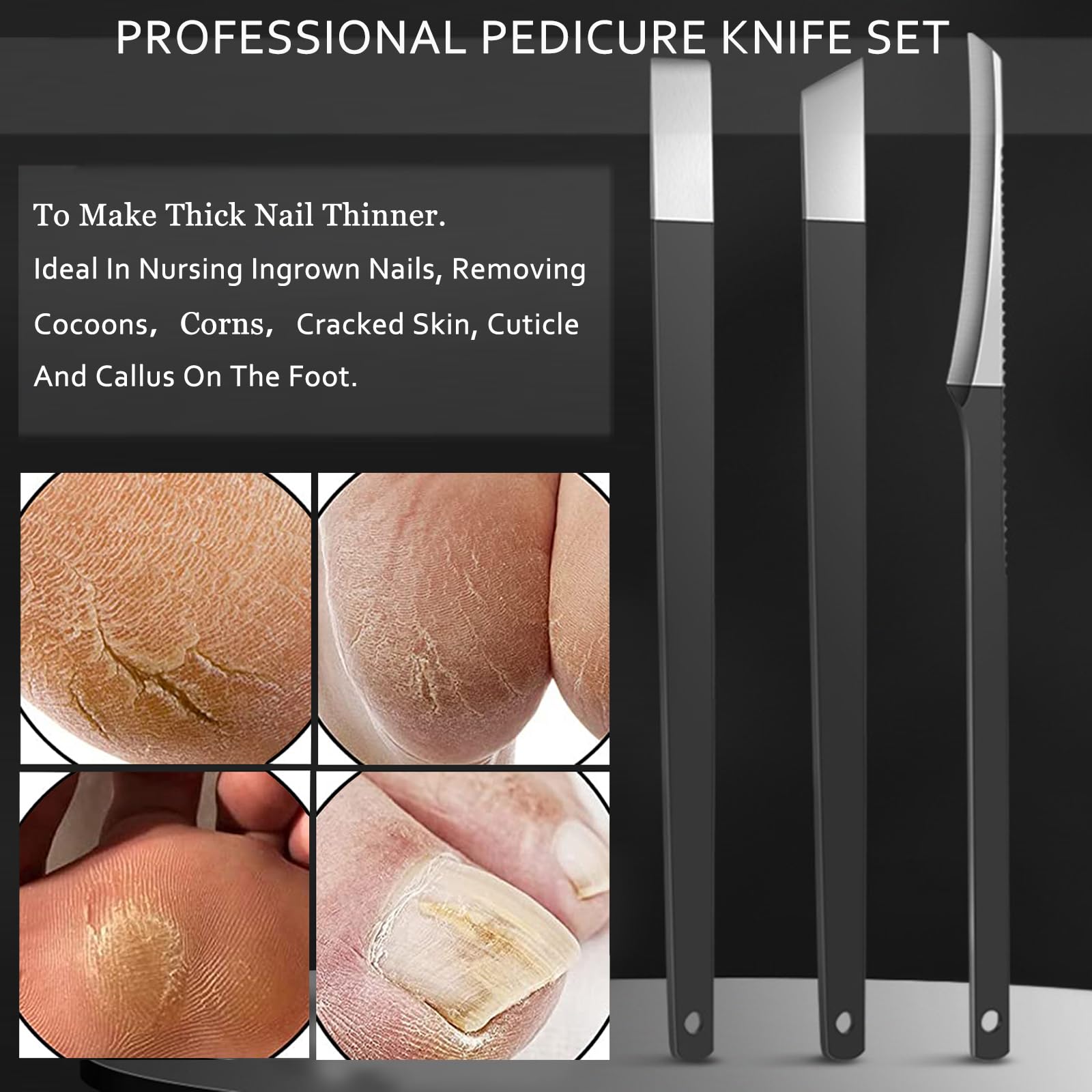 Cortador de uñas de los pies, cuchillo de pedicura para uñas encarnadas, cortador de uñas gruesas, kit de tratamiento de corrección de uñas de los pies, cuchillo de callos