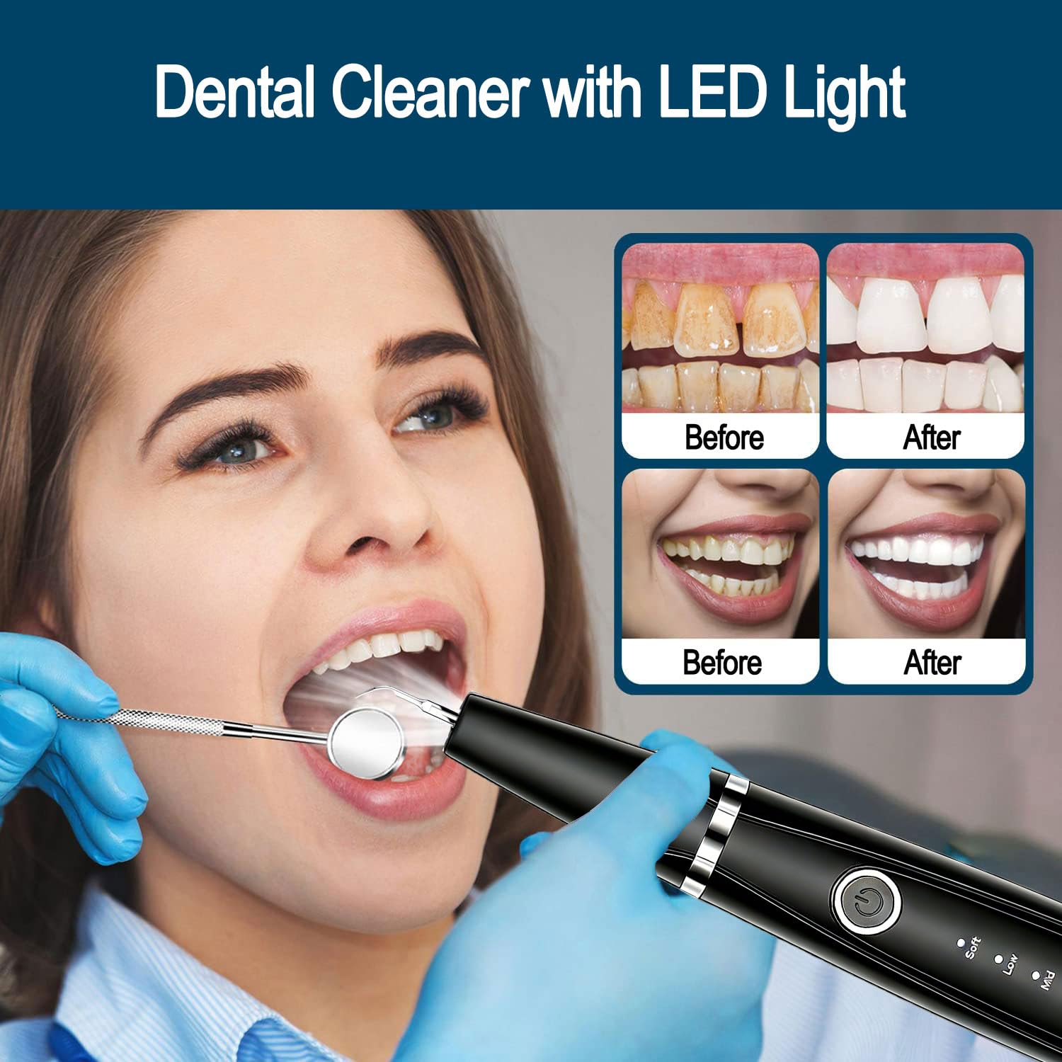 Ujhosld Sonic - Limpiador dental con luz LED, herramienta de limpieza de dientes de 5 modos, 3 cabezales reemplazables para el hogar y viajes, IPX6 impermeable
