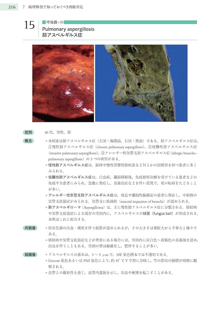 Amazon.co.jp: 病理解剖ビジュアルテキスト : 清水道生, 清水