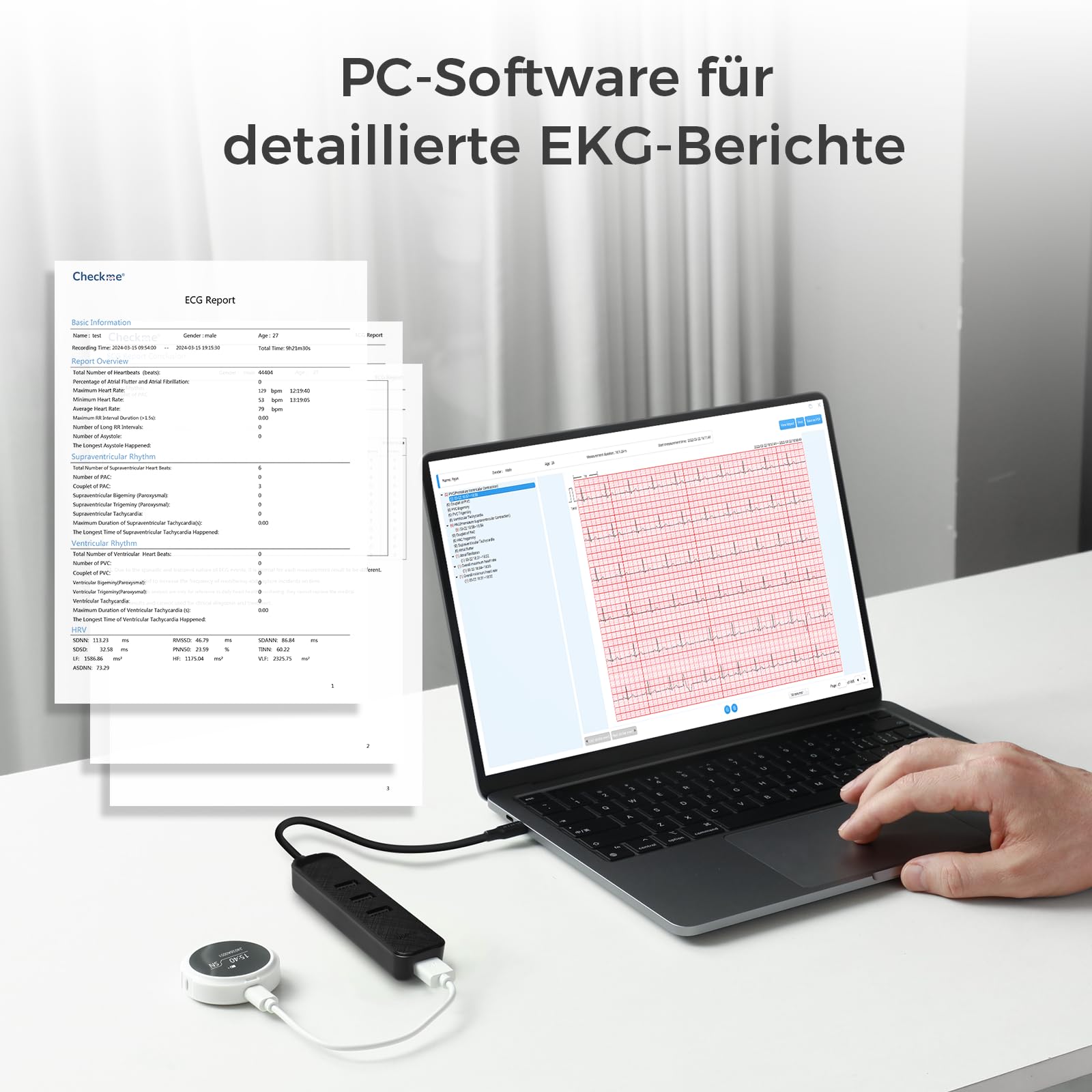 CheckMe LepodPro ECG portable à 12 dérivations avec écran OLED, enregistrement ECG en temps réel pendant 24 heures, marqueurs d'événements, rapport ECG détaillé par IA, rechargeable, support pour