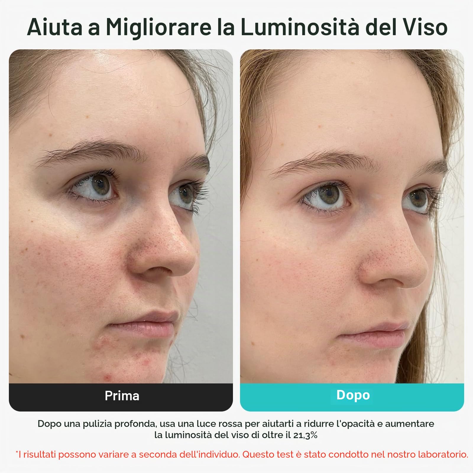 Aspiratore Punti Neri Viso Rimuovi Punti Neri Naso Elettrico Aspira Rimozione Estrattore Pulizia Viso Tramite con Impacco Caldo e Freddo Togli