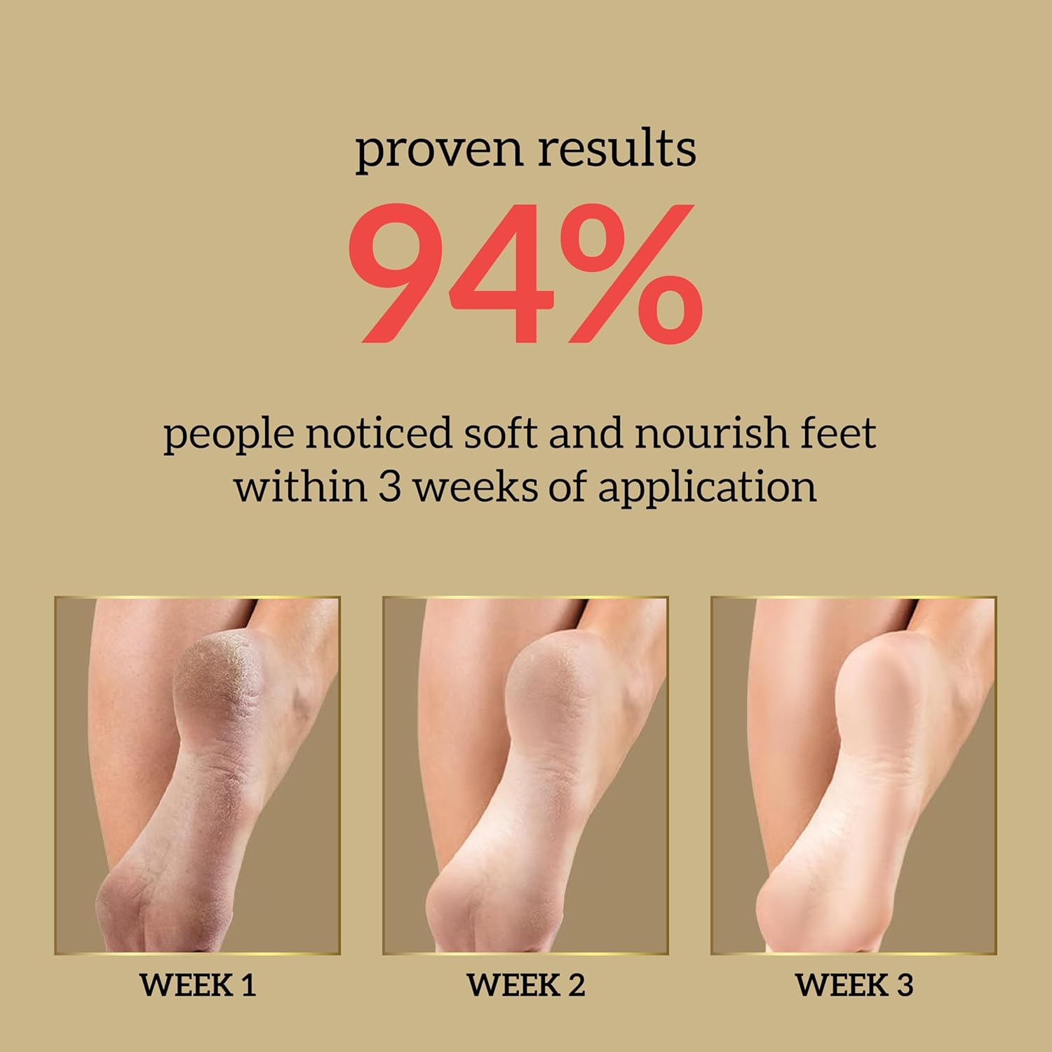 Inatur Shea Butter Foot Cream 50g - Intensive Foot Cream for Dry and Cracked Feet | Best Foot Cream for Very Dry Feet | Foot Cream for Women with Deep Moisturizing Care for Rough & Cracked Heels 6 71PRgl6FSkL. SL1500