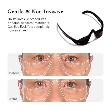 Capillus Eyelift Red Light Therapy for Eyes - Under Eye Red Light Therapy Glasses 685nm - Red Light Therapy for Eyes Bags, Wrinkles, Fine Lines, Crow's Feet and Dark Circles