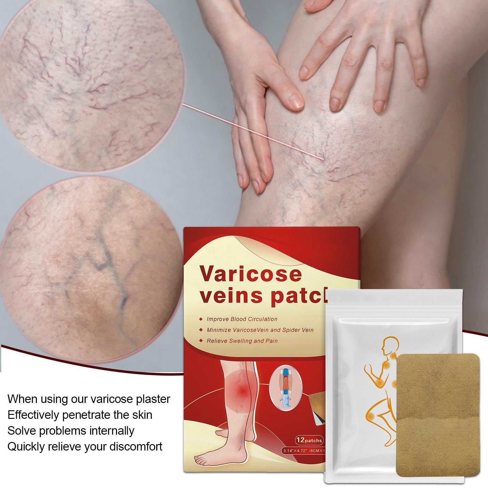 Parche de microagujas Vein Target: pasta para la circulación de 12 piezas, reducción de la hinchazón varicosa, aplicación externa para la salud, mejora la circulación, reduce la hinchazón de las piern