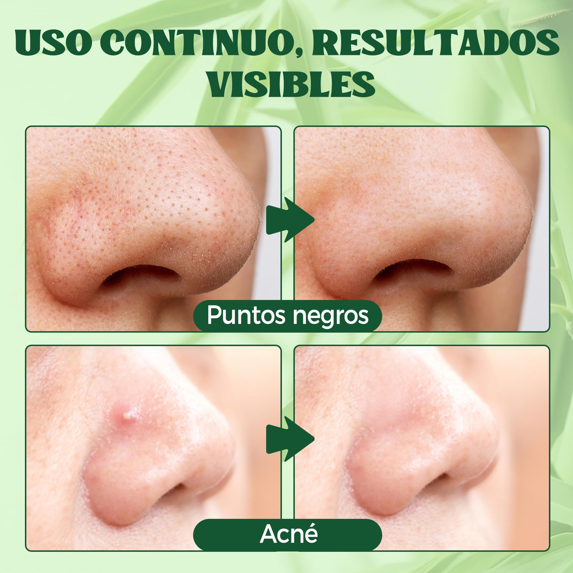 HuakChai 80 Tiras Puntos Negros Nariz, Tiras de Carbón Activo para Limpieza Profunda de Poros, Elimina Espinillas y Exceso de Grasa, Cuidado Facial para Hombre y Mujer — view 3