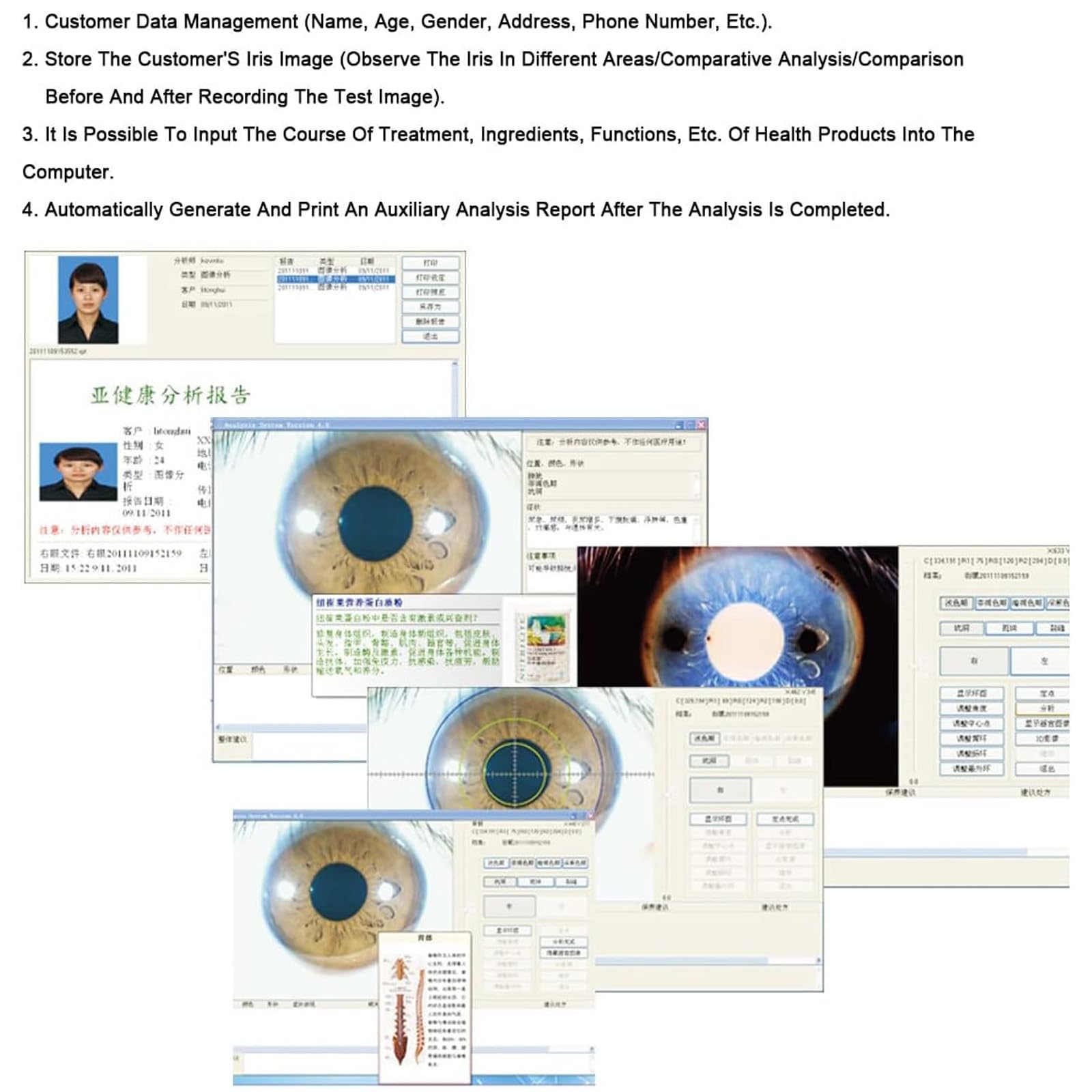 Iriscope USB per PC - Telecamera Iridologica Zoom 8MP, Analisi delle lenti dell'iride HD 30x Software per l'iride inglese Pro per Archiviazione/Confronto, Strumento Diagnostico Medico