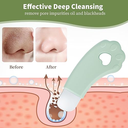 Miniatura 3 de Herramientas para quitar puntos negros, espátula facial, limpiador de espinillas, limpiador de poros, herramienta de limpieza profunda facial,