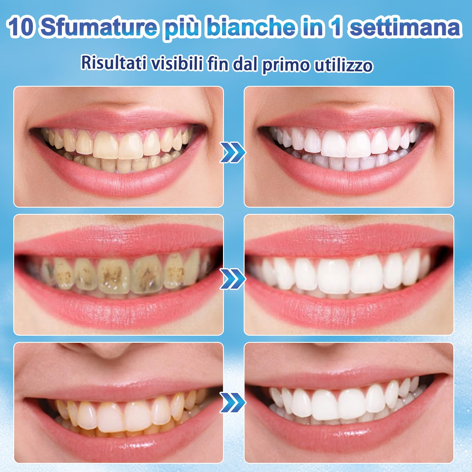 Penna sbiancante per denti (4 penne), gel sbiancante dentale professionale, set di penne sbiancanti per denti bianchi e brillanti, sbiancanti denti istantanei che eliminano le macchie