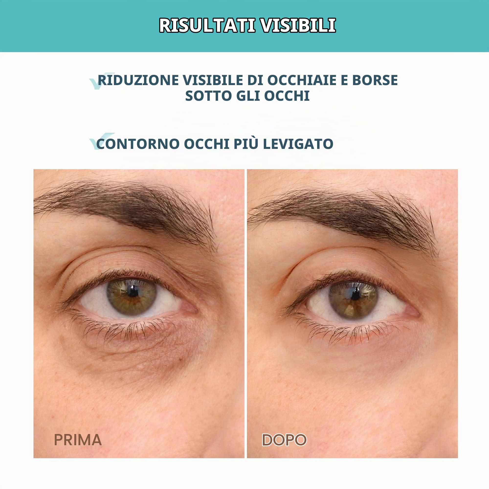 FOREO IRIS Crema per Contorno Occhi Antirughe e Occhiaie - Acido Ialuronico - Vitamina C e Vitamina E - Antiossidante - Vegano - Formato viaggio - Tutti i tipi di pelle