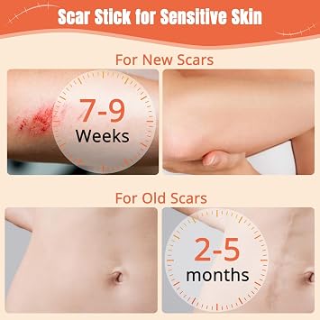Silicone Scar Stick, Skin Scar Solutions for Face and Body, Lightweight & Easy to Apply, Gentle on All Skin Types, Scar Stick for Sensitive Skin