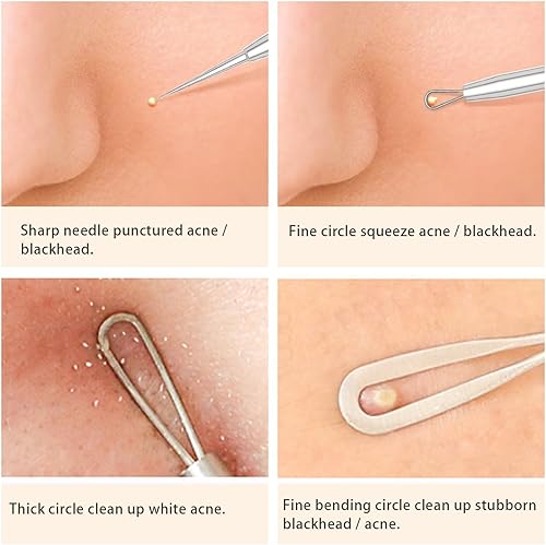 Miniatura 6 de Eliminador de puntos negros con cámara, herramientas de eliminación de puntos negros visuales WiFi con luces blancasazules para iPhone, teléfonos