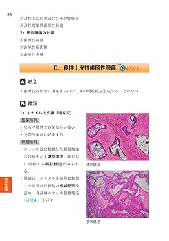 歯科国試パーフェクトマスター 病理学・口腔病理学 第2版 | 槻木