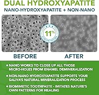 Vista 3 de Pasta de dientes nano hidroxiapatita libre de flúor pasta de dientes remineralizante profesional formulada por dentistas más xilitol anticaries