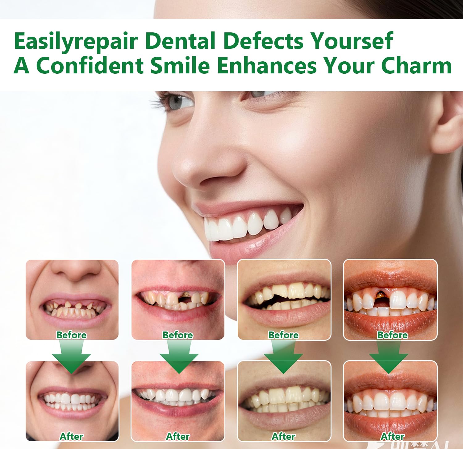 Cemento Dental Permanente 60g Kits de Empastes Dentales Perla Dental Reparación Dientes Falsos Moldeables