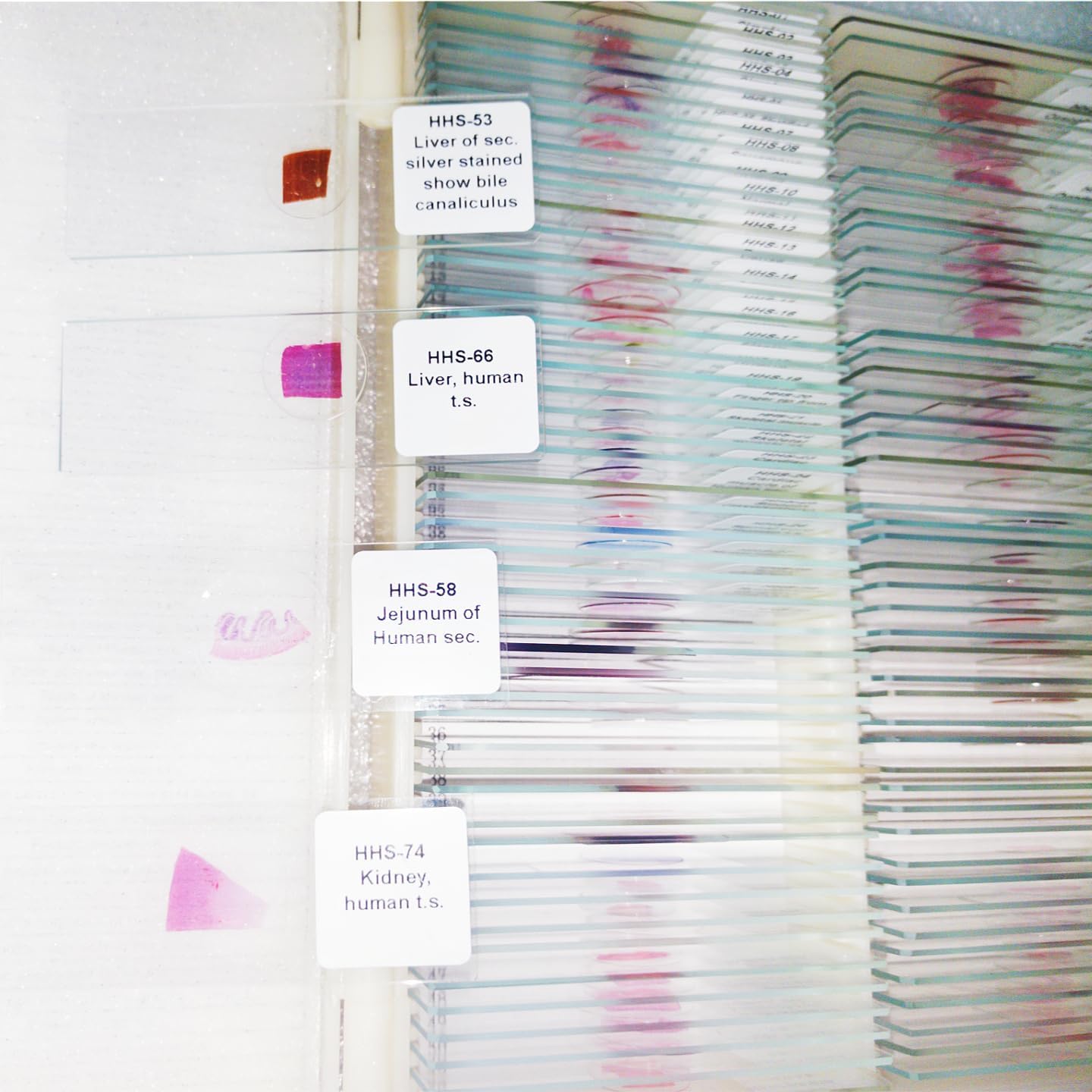 100 Pieces Human Histology Microscope Slides for Medical Education (Higher Standard)