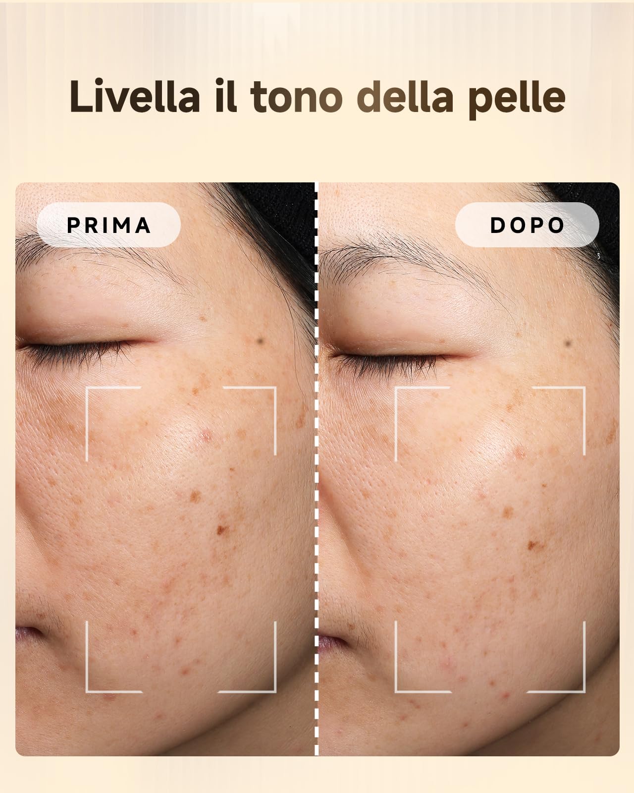 Luce del Latte Massaggiatore Viso Lifting Massaggiatore Viso a Infrarossi Pulsati Anti-rughe Anti-età Adatto per Pelle Sensibile