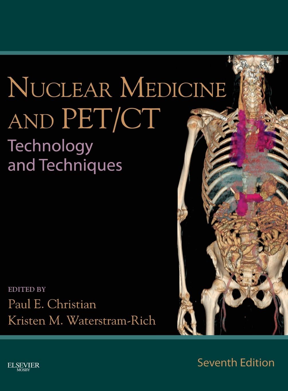 Nuclear Medicine and PET/CT: Technology and Techniques