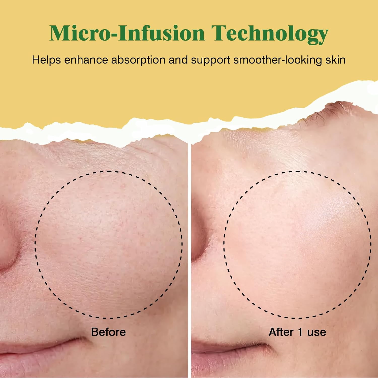 Celistar Micro Infusion Derma Stamp with Peptide & Collagen Serum 2 Month | Deep hydration & anti-aging; microbiome & exosome support; collagen + antioxidant boost; stem cell/probiotic skin renew