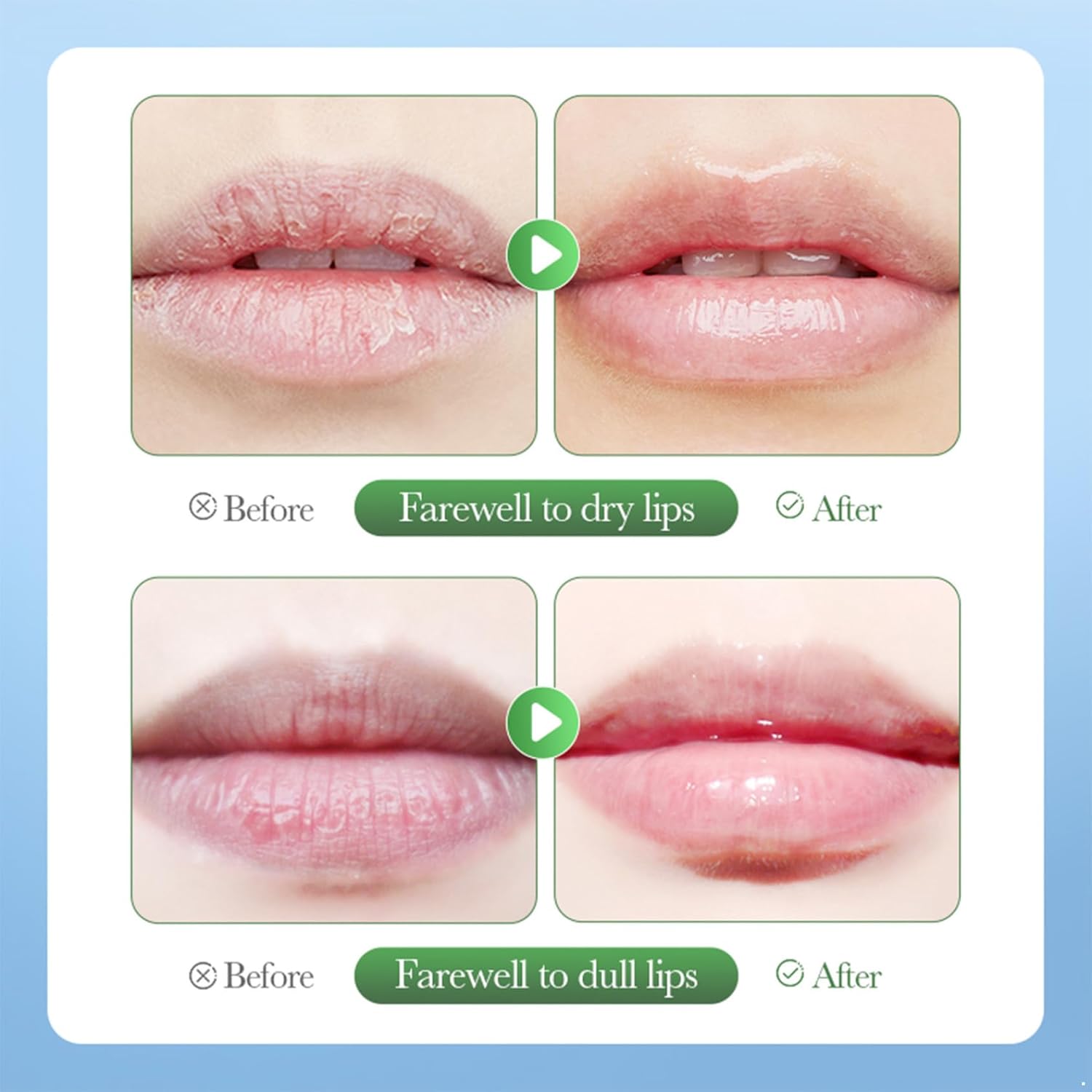 Vxuxlje 1Pc Softening Lip Exfoliant – 20g Fruit Flavor, Removes Flakes for Hydrated & Smooth Feel Avocado One Size
