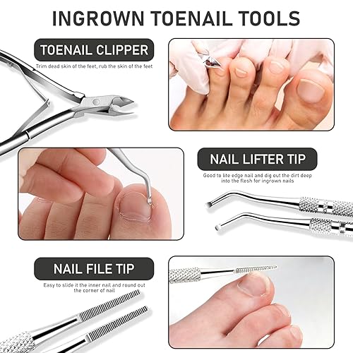 Miniatura 10 de Paquete de 6 limas y levantadores de uñas encarnadas, kit de herramientas profesionales de eliminación de uñas de los pies encarnadas de acero